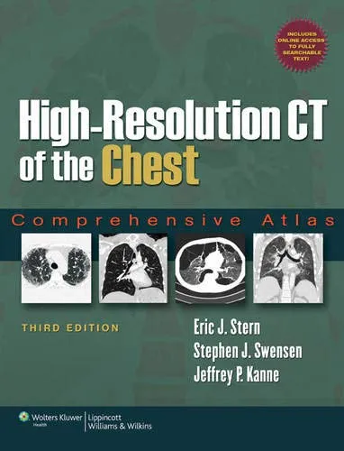 High-Resolution CT of the Chest - 3rd Edition