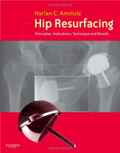 Hip Resurfacing