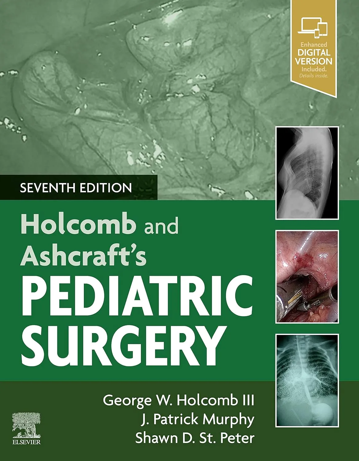 Ashcraft's Pediatric Surgery - 7E