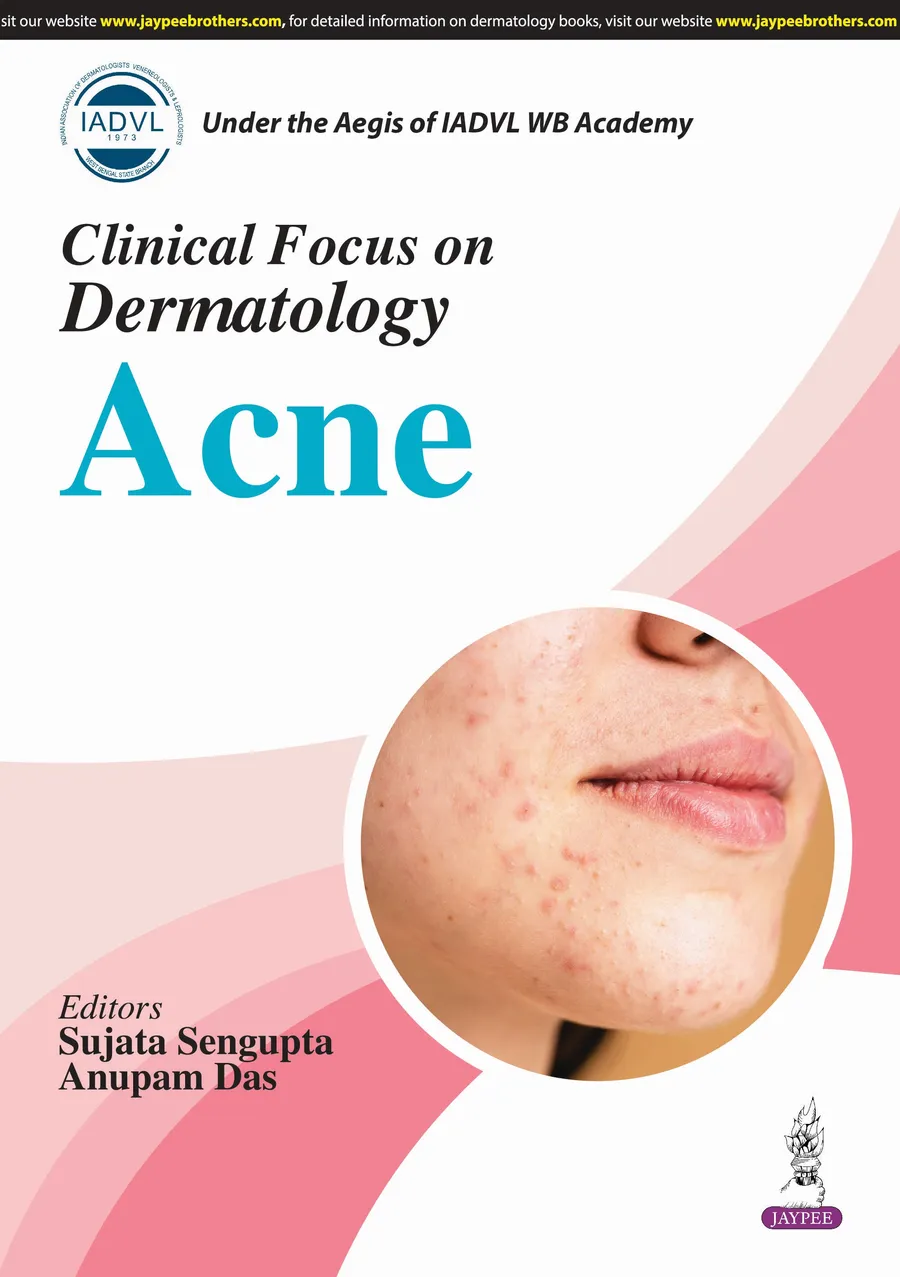 IADVL Clinical Focus on Dermatology Acne