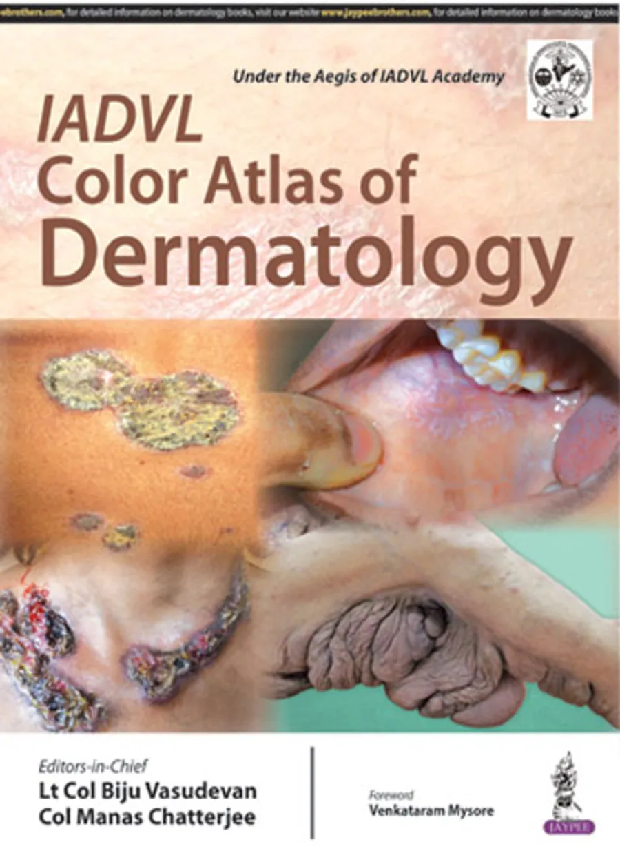 IADVL Color Atlas of Dermatology