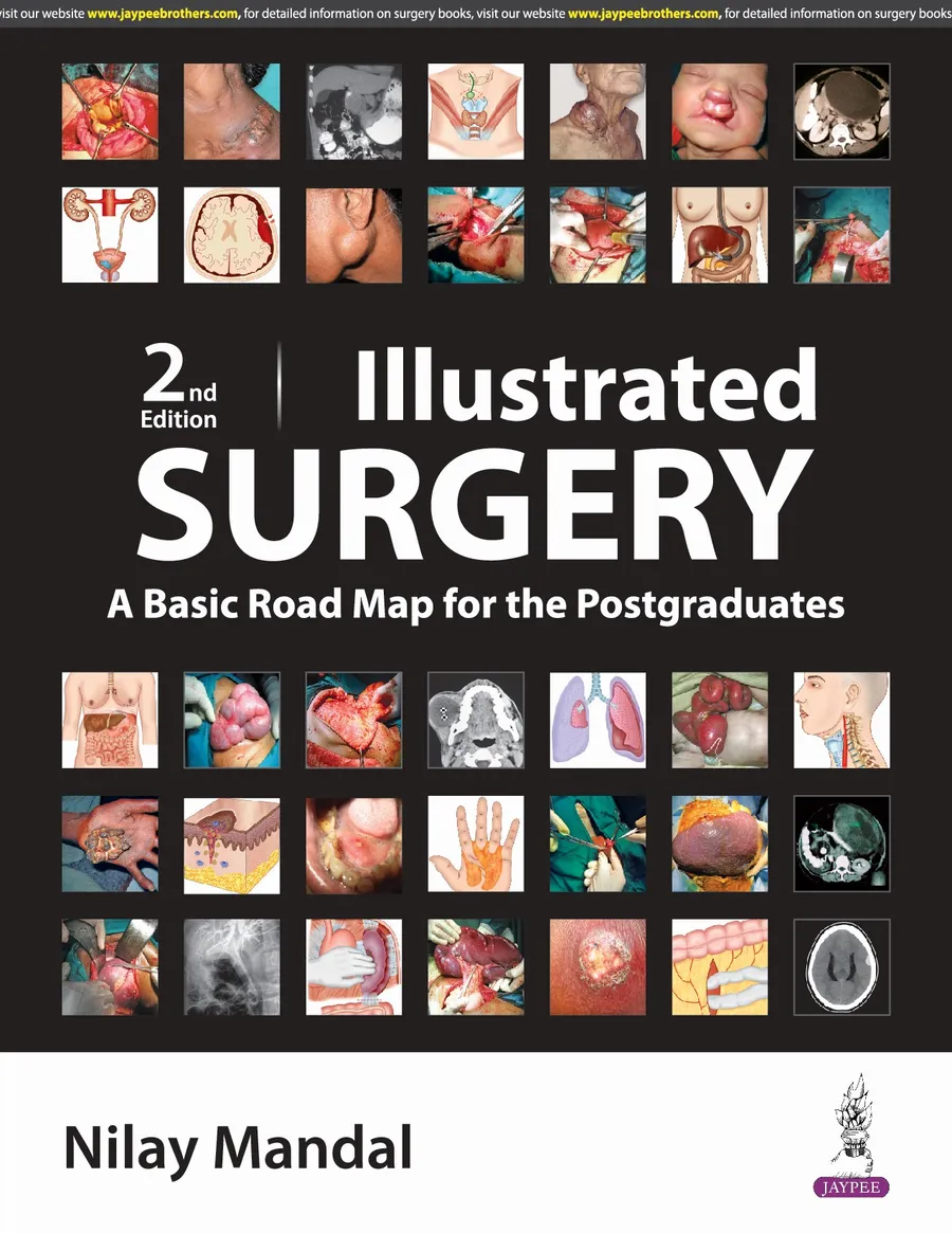 Illustrated Surgery | A Basic Road Map For The Postgraduates