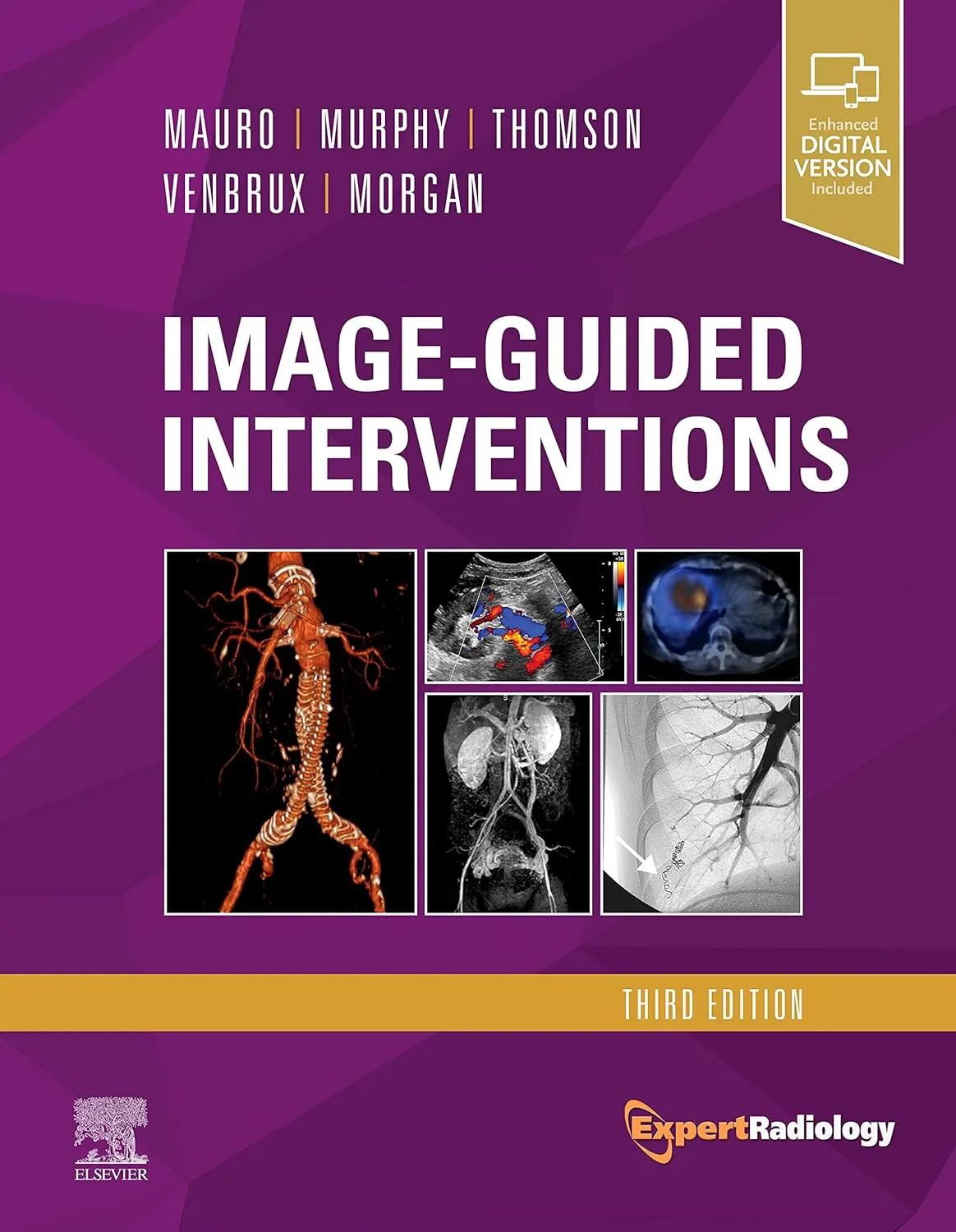 Image-Guided Interventions-3E