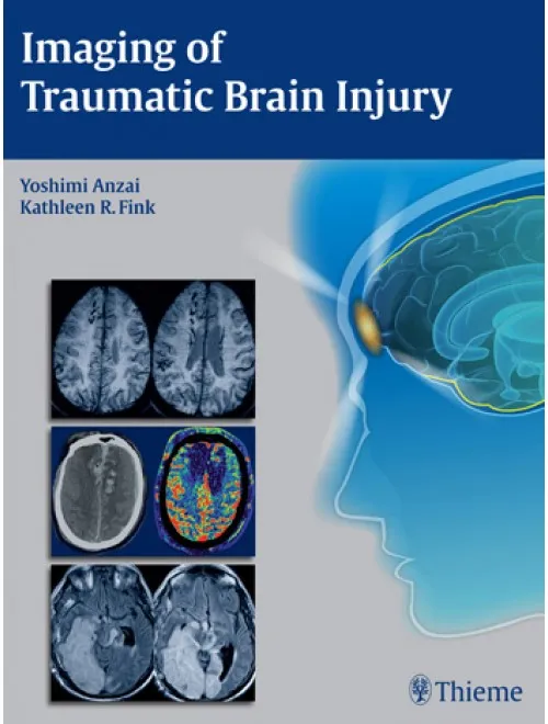 Imaging of Traumatic Brain Injury
