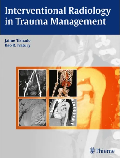 Interventional Radiology in Trauma Management - 1st Edition