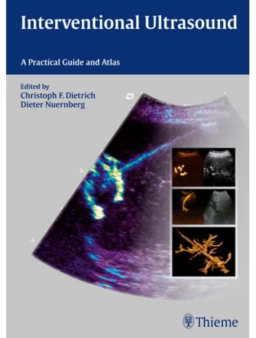 Interventional Ultrasound - 1st Edition