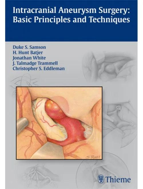 Intracranial Aneurysm Surgery - 1st Edition