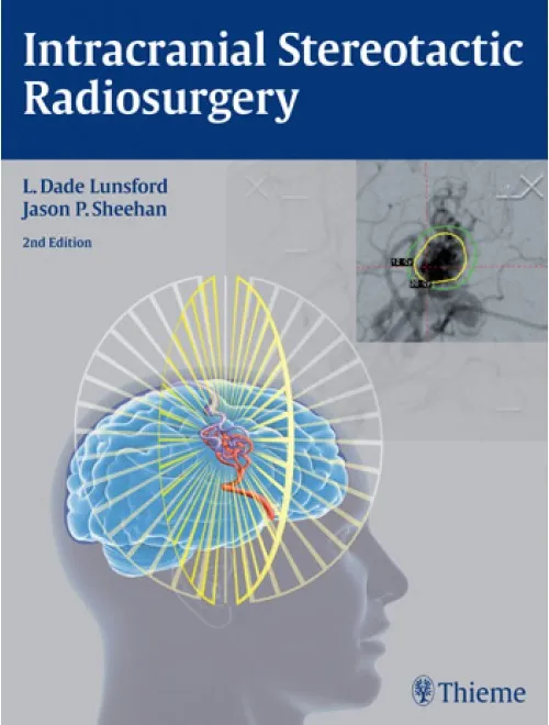 Intracranial Stereotactic Radiosurgery - 2nd Edition
