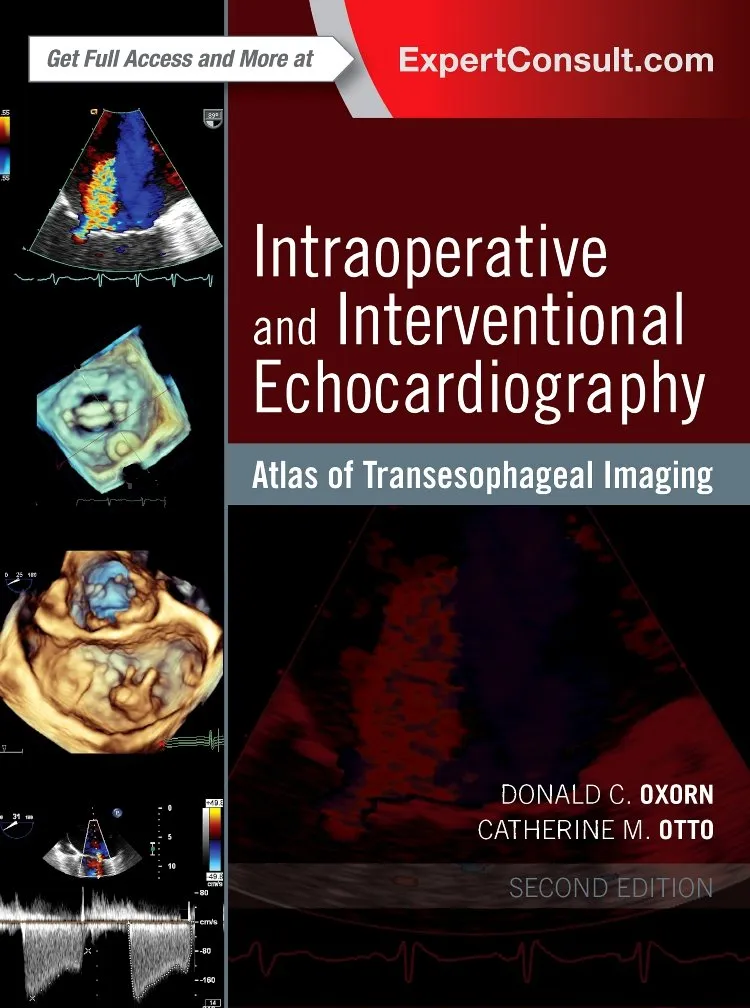 Image of Intraoperative and Interventional Echocardiography: Atlas of Transesophageal Imaging - 2E