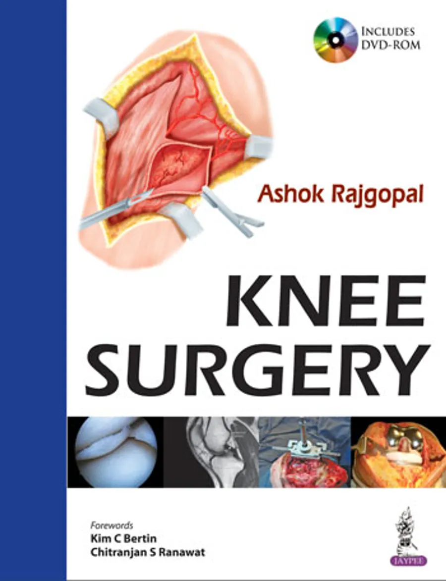 Knee Surgery (with Interactive DVD Rom)