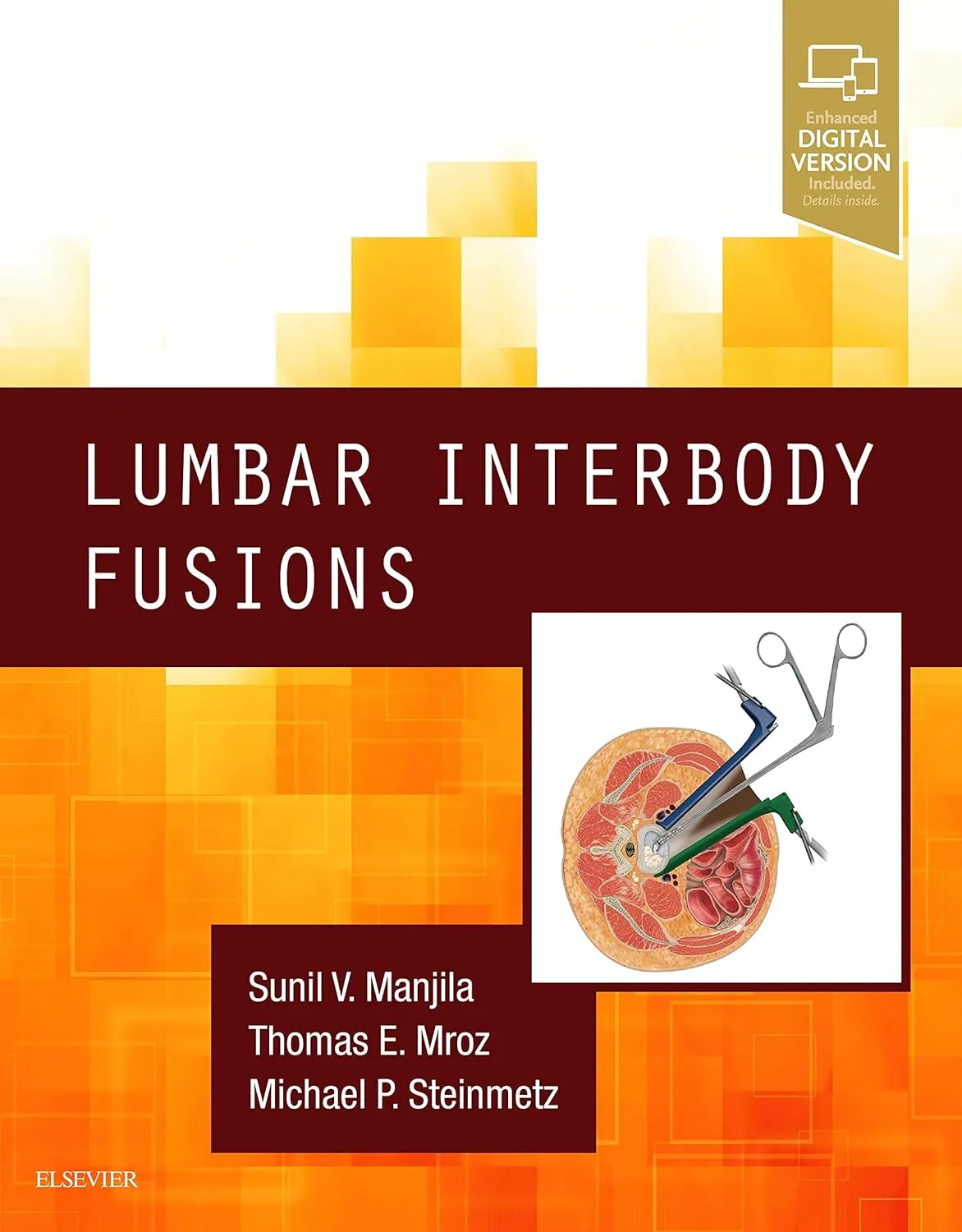 Lumbar Interbody Fusions -1E