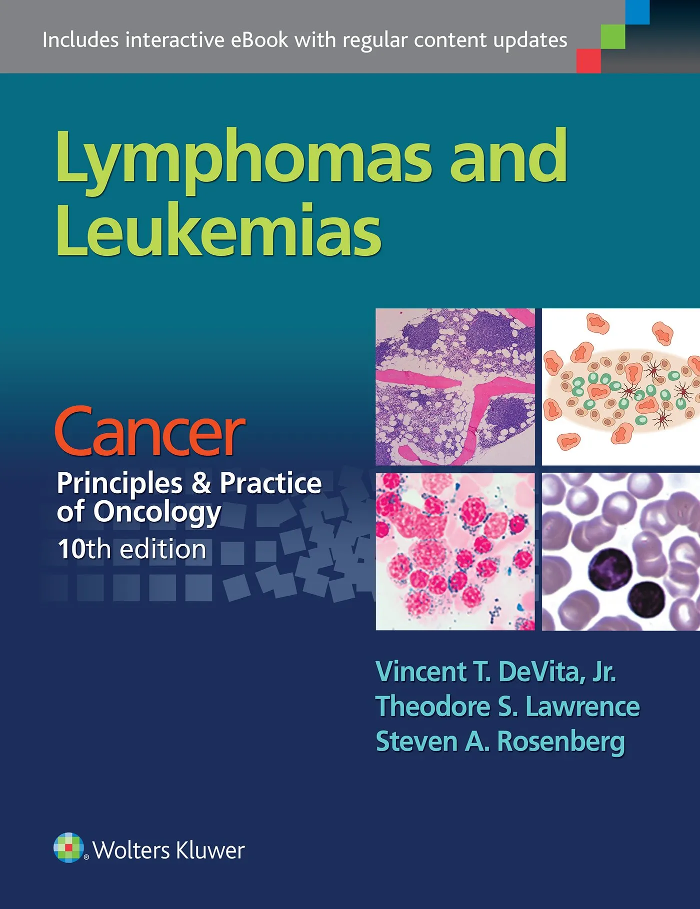 Lymphomas and Leukemias: Cancer:  Principles and Practice of Oncology, 10th edition