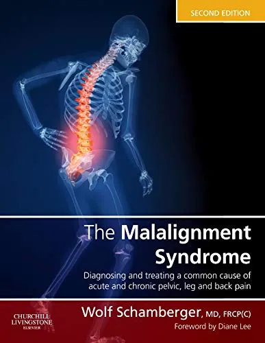 The Malalignment Syndrome Diagnosis and Treatment of Common Pelvic and Back Pain- 2nd Edition
