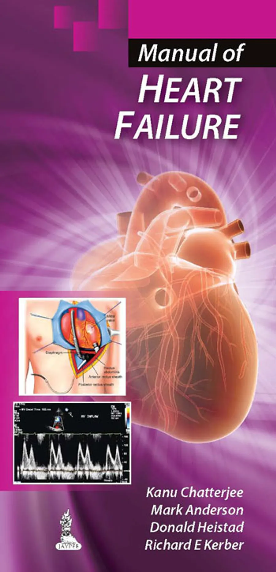 Image of Manual of Heart Failure