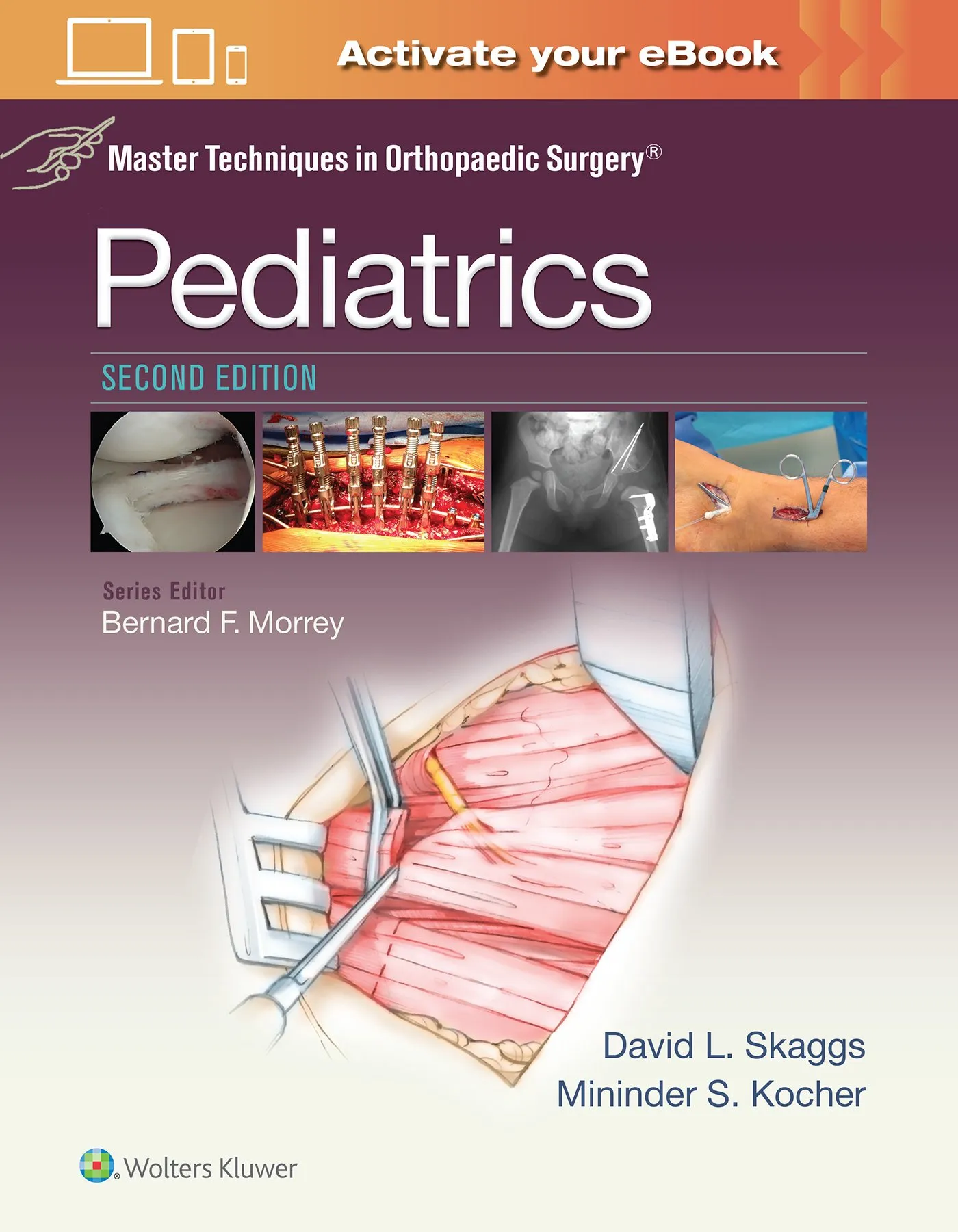 Master Techniques in Orthopaedic Surgery: Pediatrics - 2nd Edition