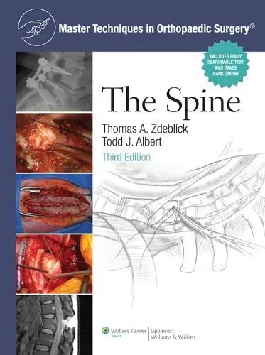 Master Techniques in Orthopaedic Surgery - The Spine