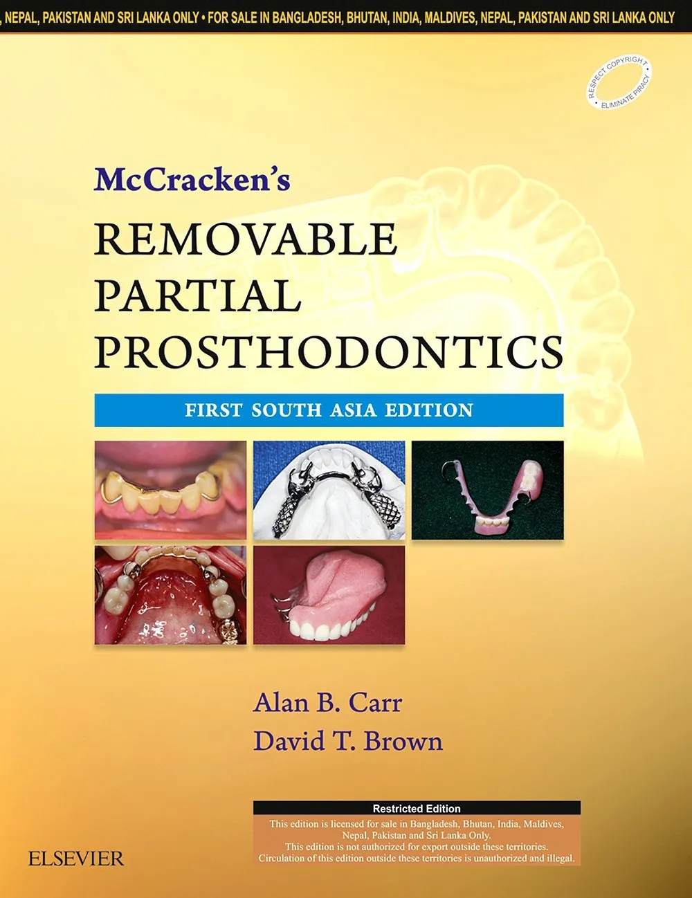 McCracken'S Removable Partial Prosthodontics - 1E