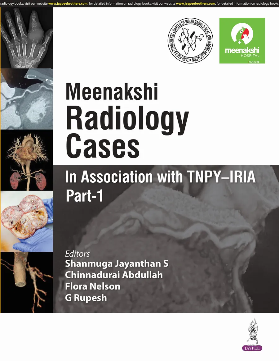 Meenakshi Radiology Cases (In Association with TNPYâIRIA) Part-1