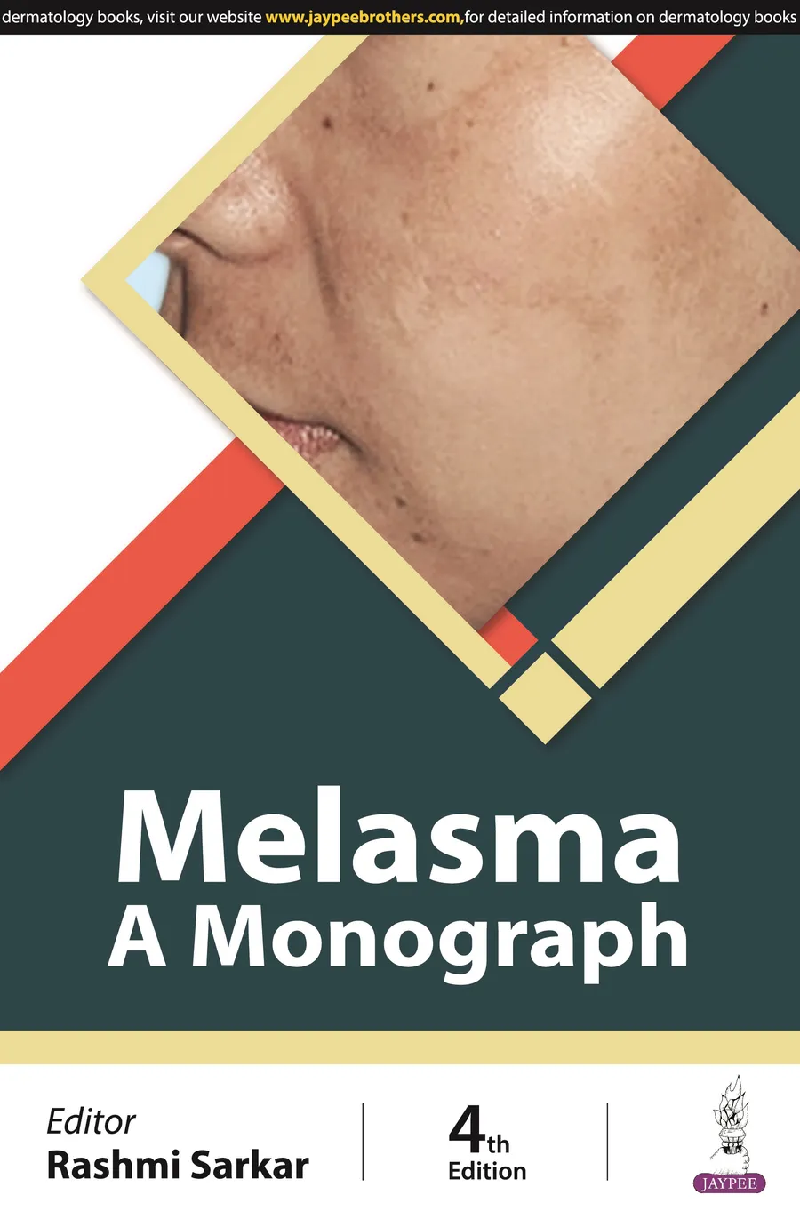 Melasma | A Monograph