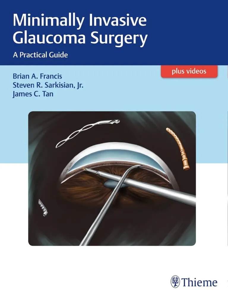 Minimally Invasive Glaucoma Surgery A Practical Guide 1st Edition