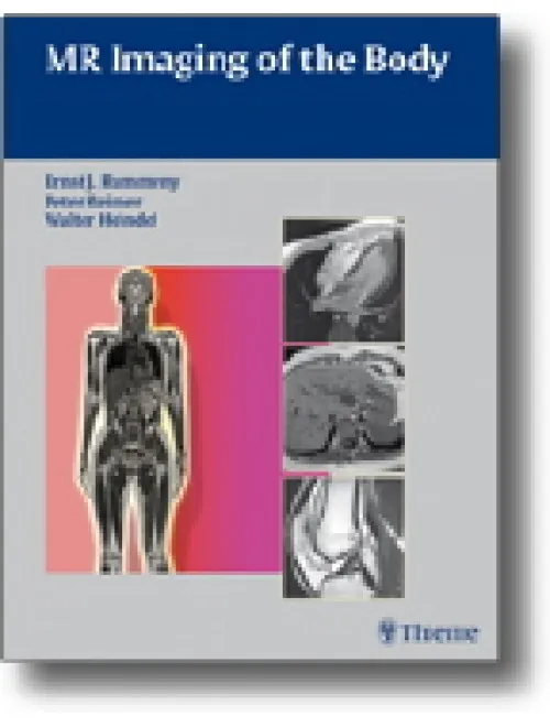 MR Imaging of the Body - 1st Edition