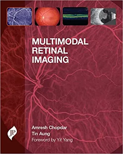 Image of as