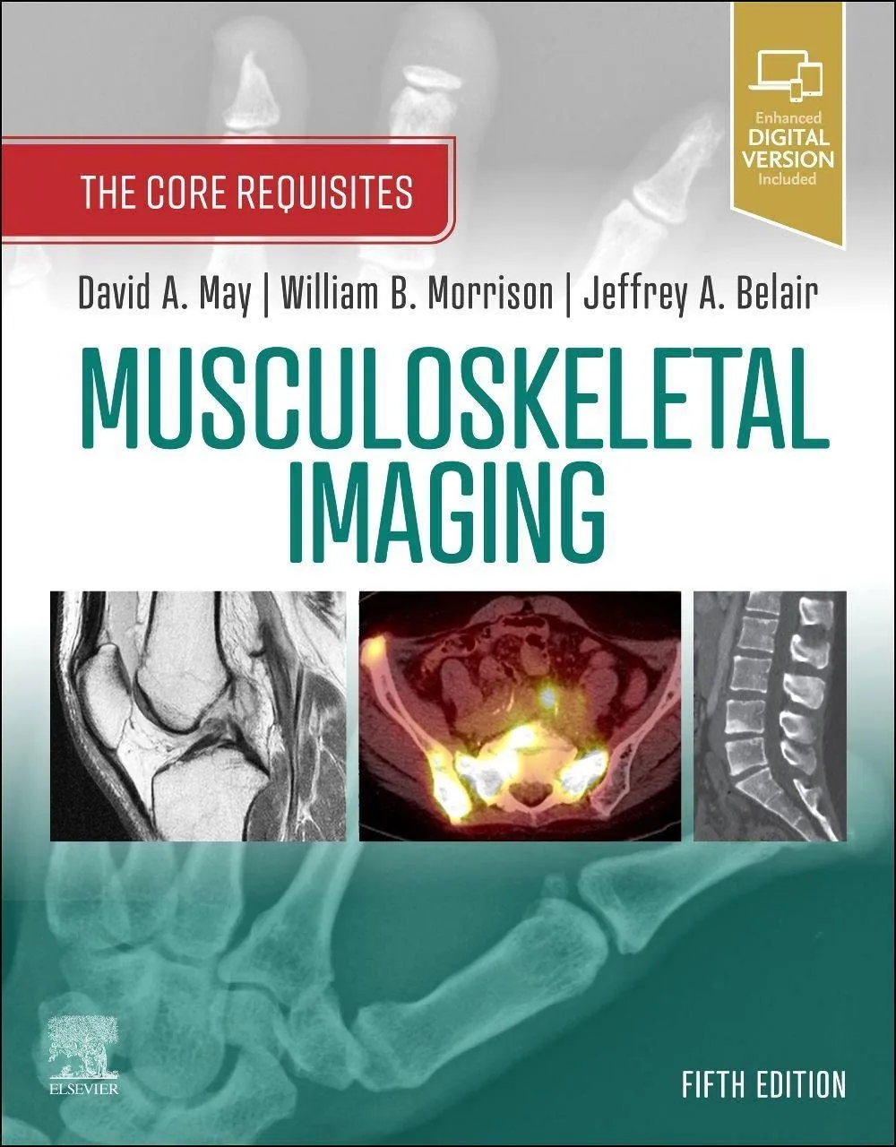 Musculoskeletal Imaging-5E