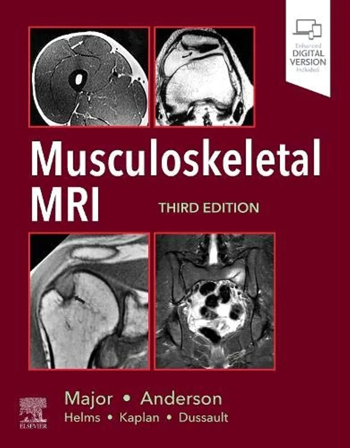 Musculoskeletal MRI - 3E