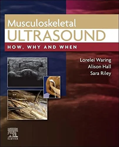 Musculoskeletal Ultrasound - 1st Edition