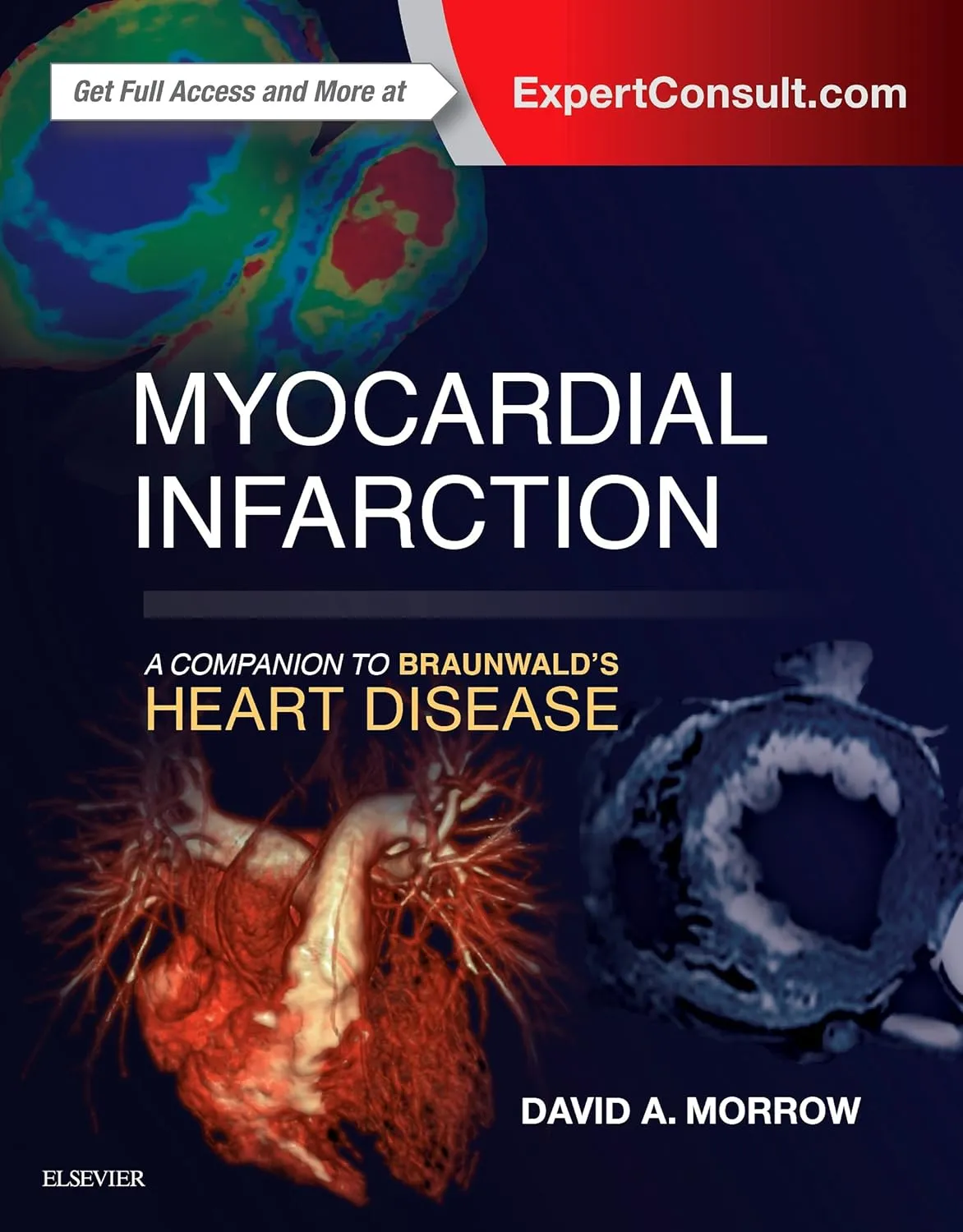 Image of Myocardial Infarction: A Companion to Braunwald's Heart Disease