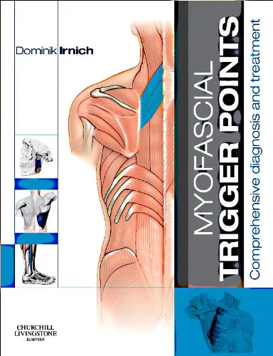 Myofascial Trigger Points Comprehensive Diagnosis and Treatment - 1st Edition