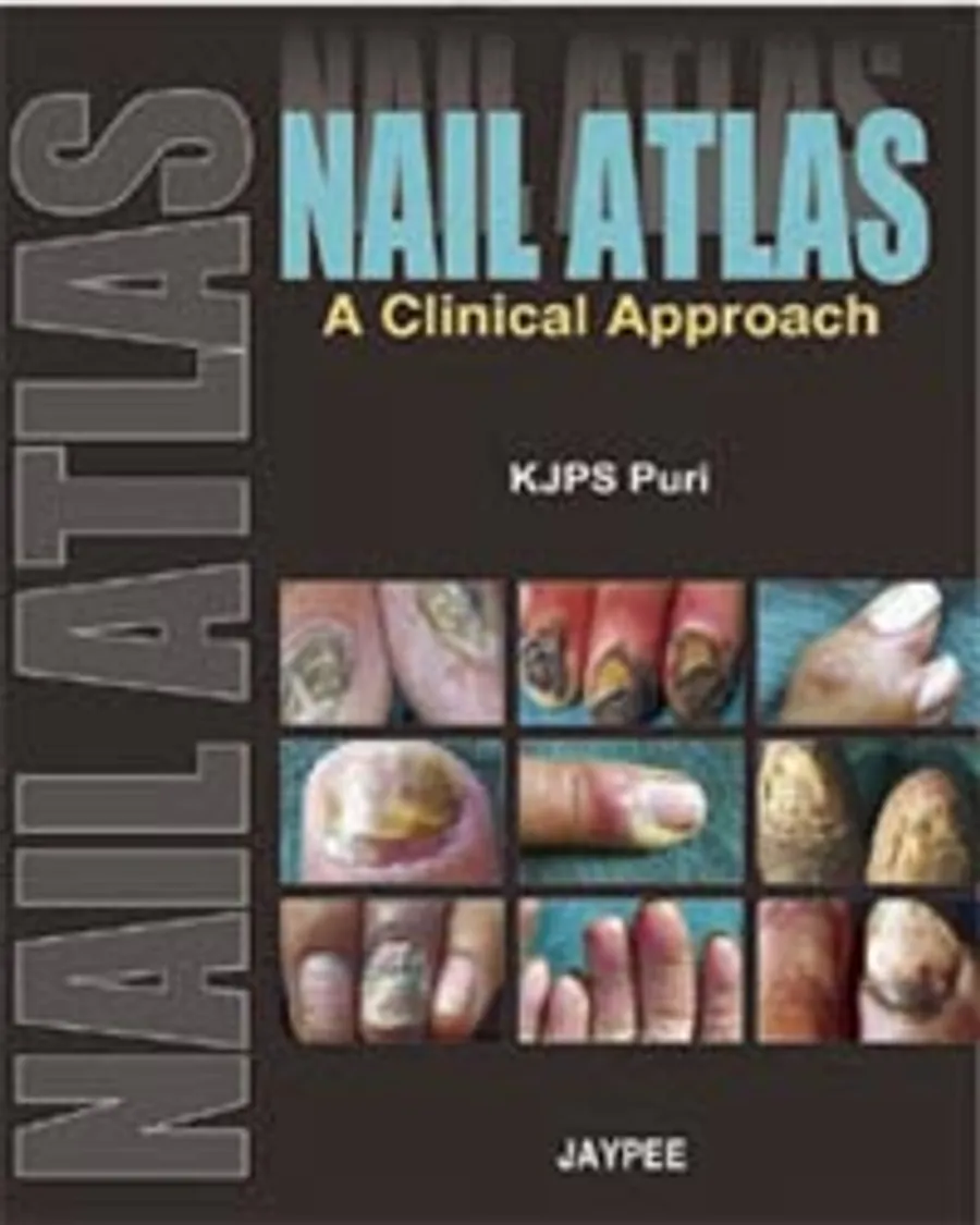 Nail Atlas | A Clinical Approach