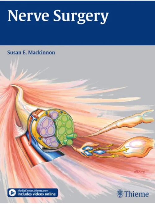 Nerve Surgery - 1st Edition