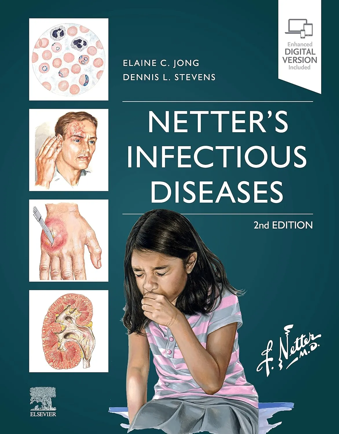 Netter's Infectious Diseases - 2ED