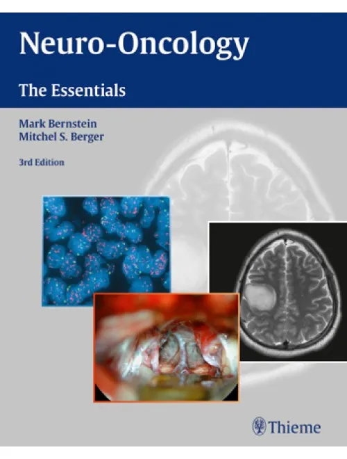 Neuro-Oncology: The Essentials - 3rd Edition