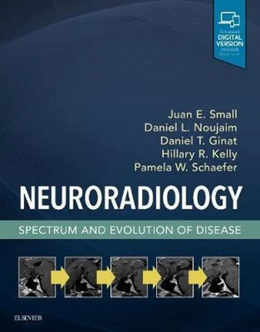 Neuroradiology: Spectrum and Evolution of Disease - 1E
