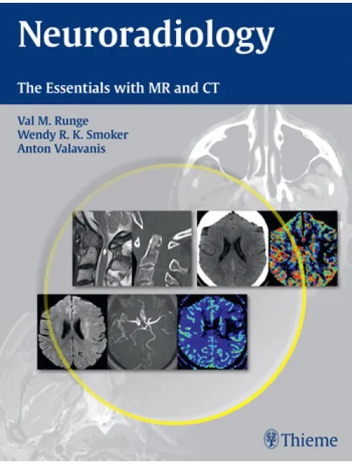 Neuroradiology-The Essentials with MR and CT - 1st Edition