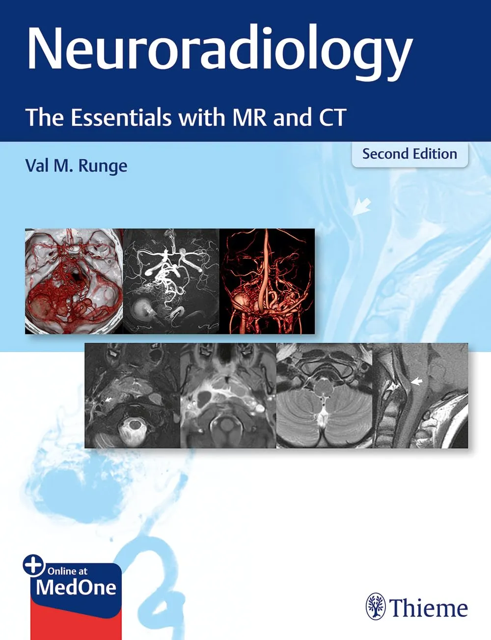 Neuroradiology : The Essentials with MR and CT 2nd Ed.