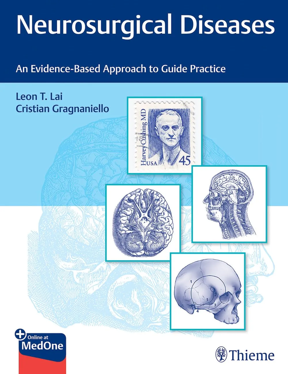Neurosurgical Diseases : An Evidence-Based Approach to Guide Practice 1st Ed.