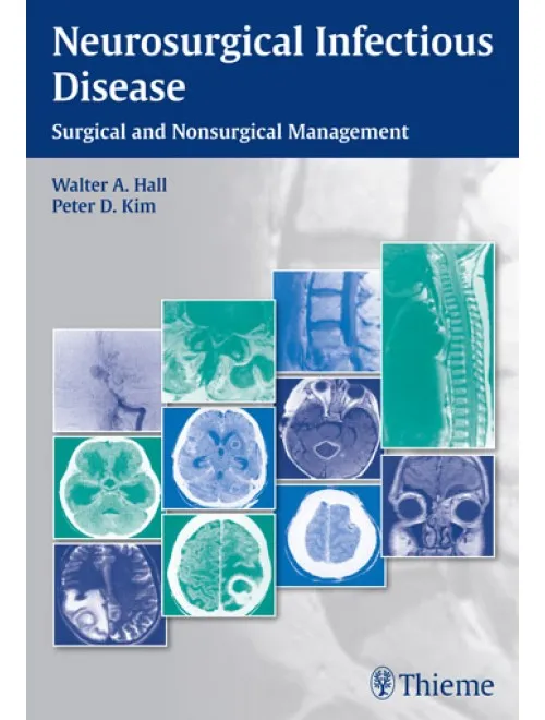 NEUROSURGICAL INFECTIOUS DISEASE - 1st EDITION