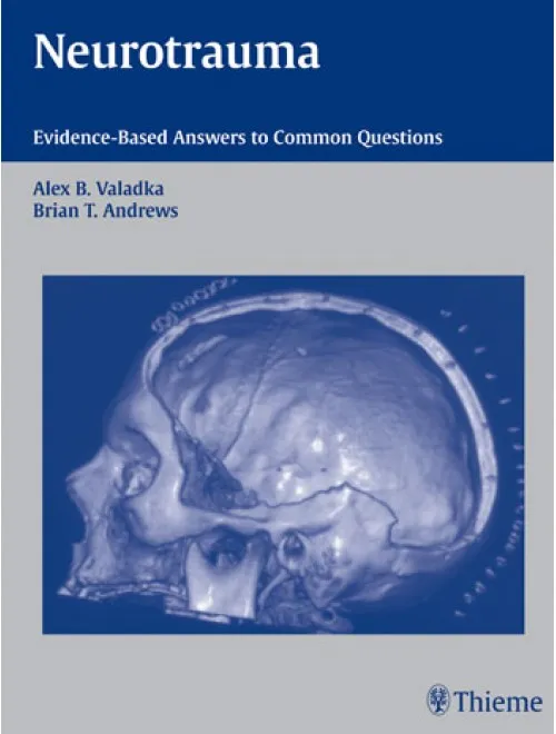 Neurotrauma - 1st Edition