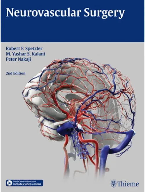 Neurovascular Surgery - 2nd Edition