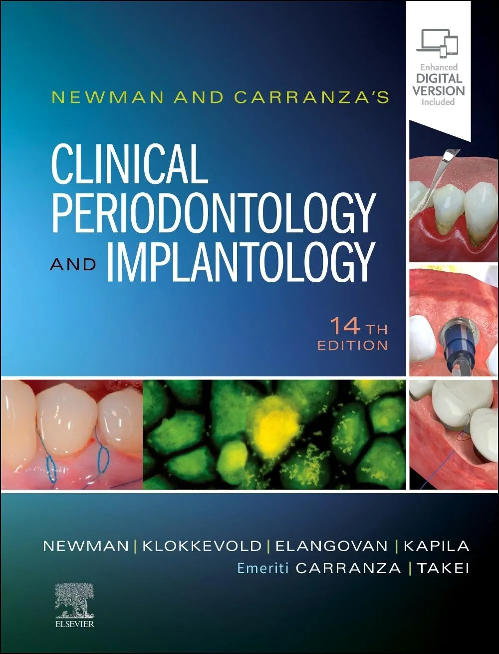 Newman and Carranza's Clinical Periodontology and Implantology-14E