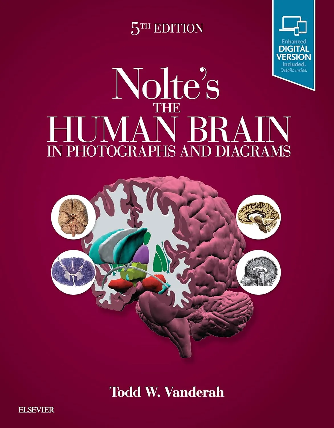 Nolte's The Human Brain in Photographs and Diagrams -5E