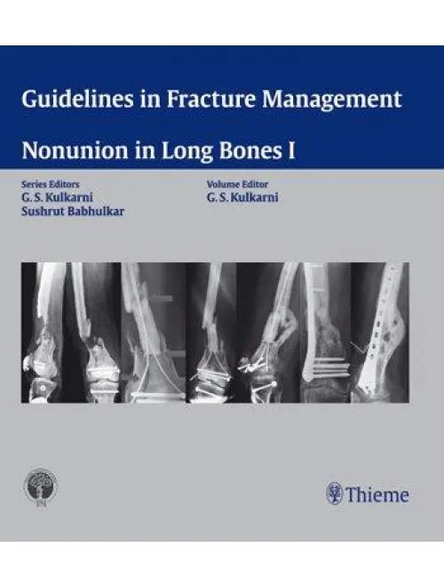 Non Union in Long Bones I - 1st Edition