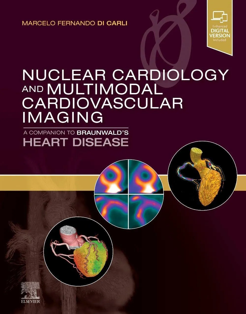 Image of Nuclear Cardiology and Multimodal Cardiovascular Imaging - 1E