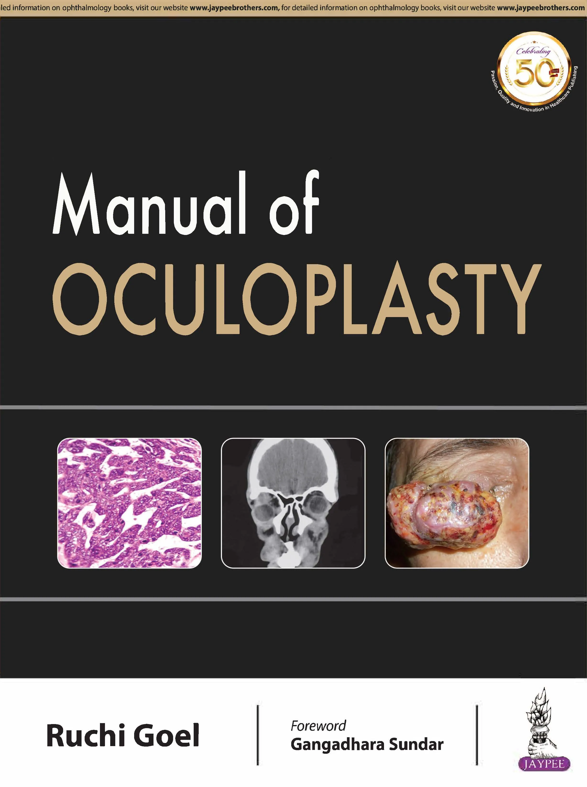 Oculoplasty Manual - 1st Edition
