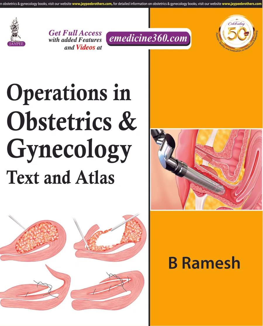 Operations in Obstetrics & Gynecology | Text And Atlas