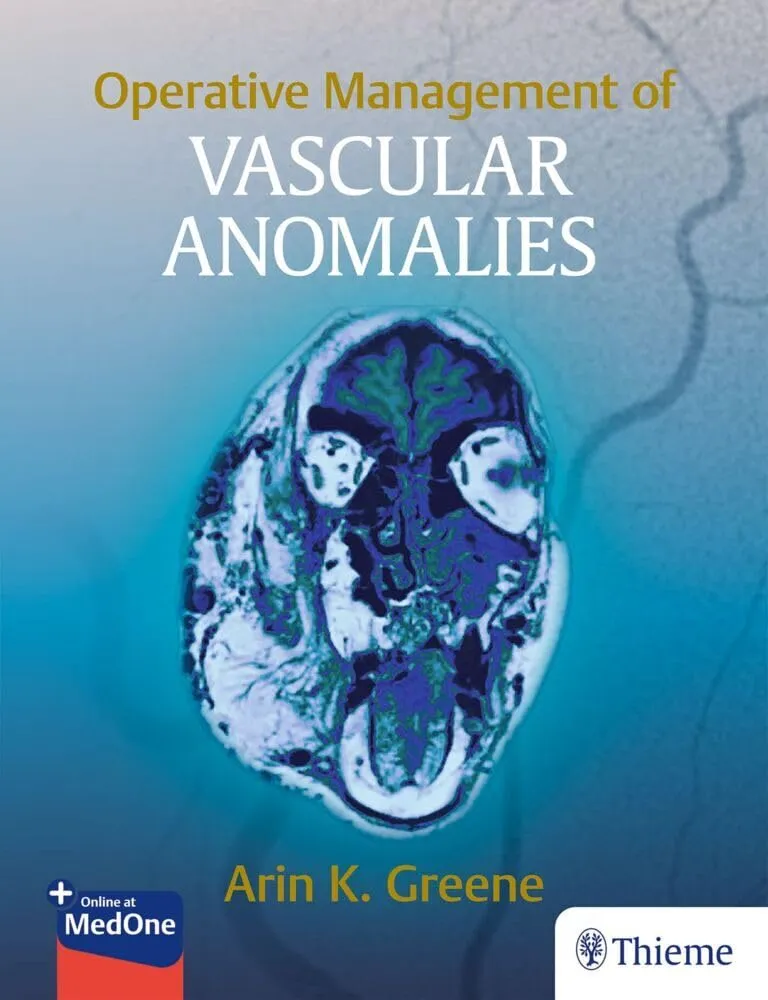 Operative Management of Vascular Anomalies 1st Edition