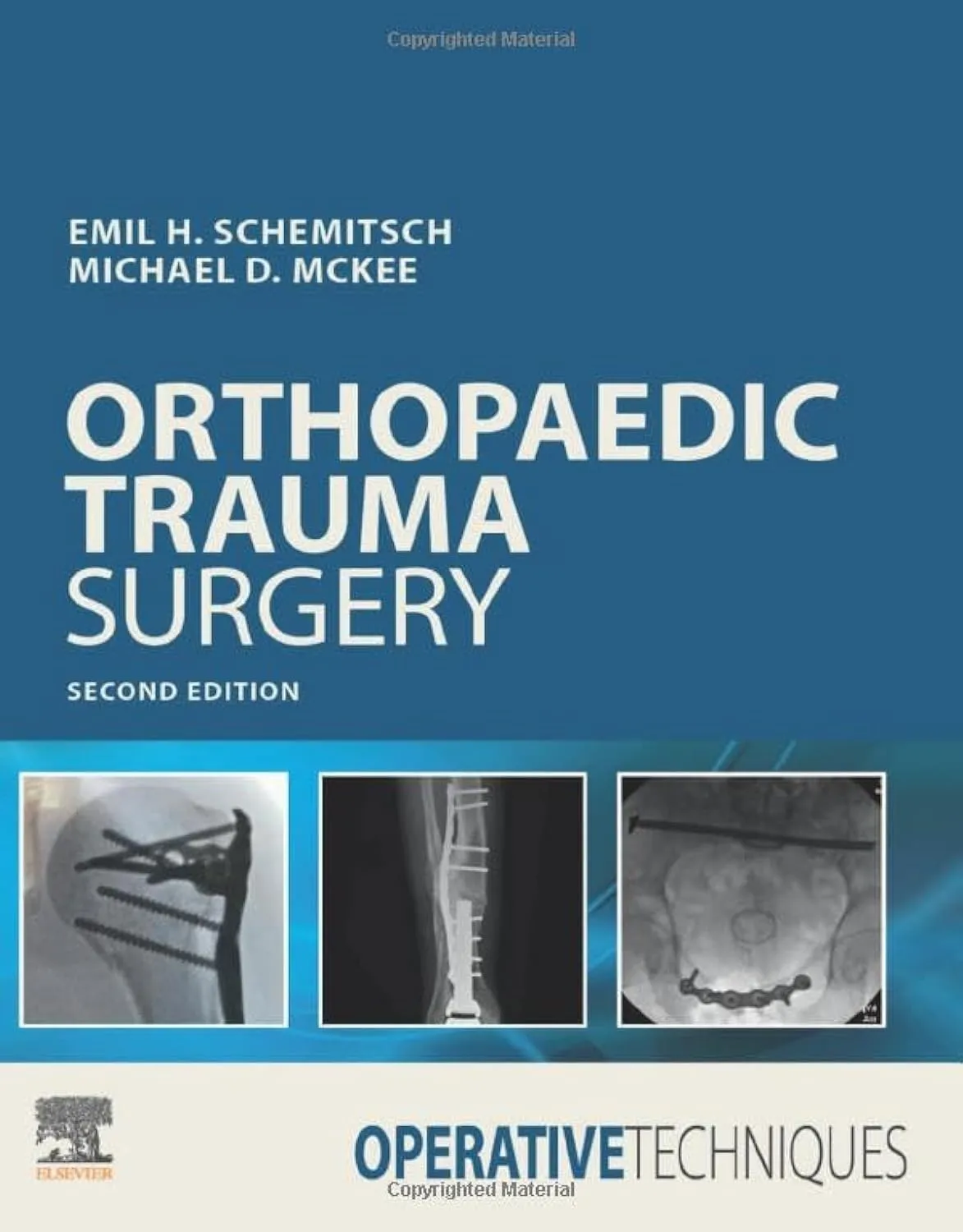 Operative Techniques: Orthopaedic Trauma Surgery - 2E